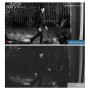 Eufy S221 Überwachungskamera 2er-Set bei Nacht: Person im Garten gefilmt.