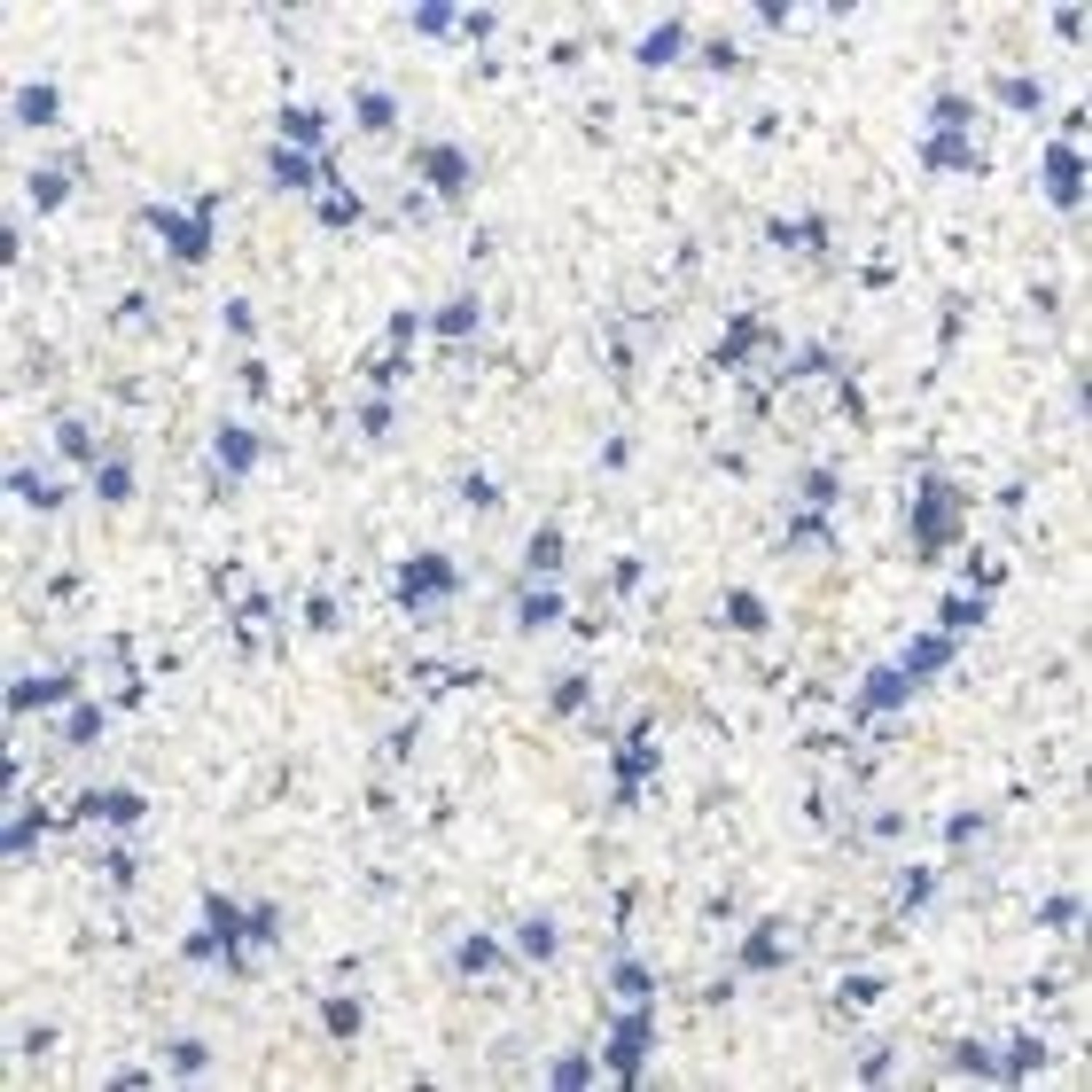 Terralith Buntsteinputz Mosaikputz, 2mm, Farbe Weiss Blau.