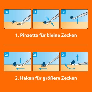 Anleitung: Ardap Zeckenzange aus Edelstahl zur Zeckenentfernung mit Pinzette und Haken.