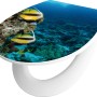 baliv WC-Sitz Garabi mit Ozean-Motiv, Absenkautomatik und weißer Brille.